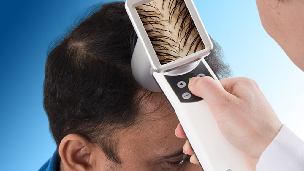 Analise capilar por IA