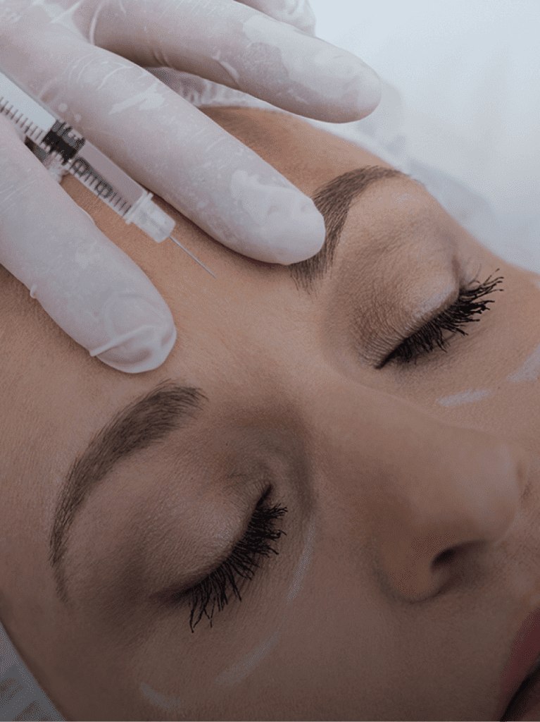 Os bioestimuladores são substâncias que, ao serem injetadas na pele, estimulam a produção de colágeno para tratamento facial e corporal